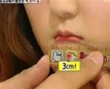 韓國鳥嘴女「嘴巴僅3cm」連漢堡都不能吃！她：很困擾