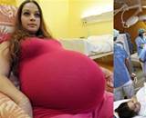 23歲媽孕肚超大「以為懷上雙胞胎」，產檢時發現「480年來才出現的奇蹟」...創下全國紀錄