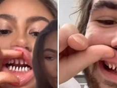 抖音瘋完美笑容的「口腔美容潮」　牙醫傻眼警告：10年後會後悔！